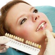 Косметическое экспресс отбеливание зубов