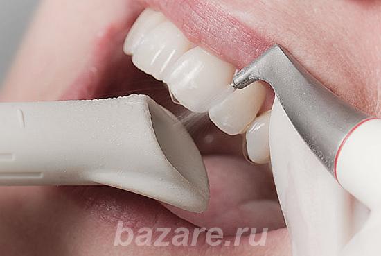 Чистка зубов AirFlow в стоматологии Дент Престиж, 